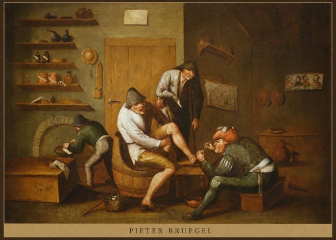 Pieter Bruegel The Foot Operation No5 - Plakat